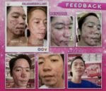 Original Brilliant Skin Rejuvenating Facial Set Clear - Image 6