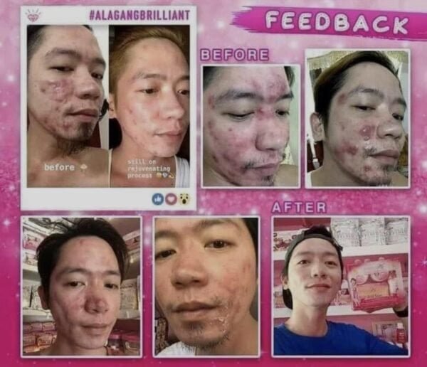 Original Brilliant Skin Rejuvenating Facial Set Clear - Image 6